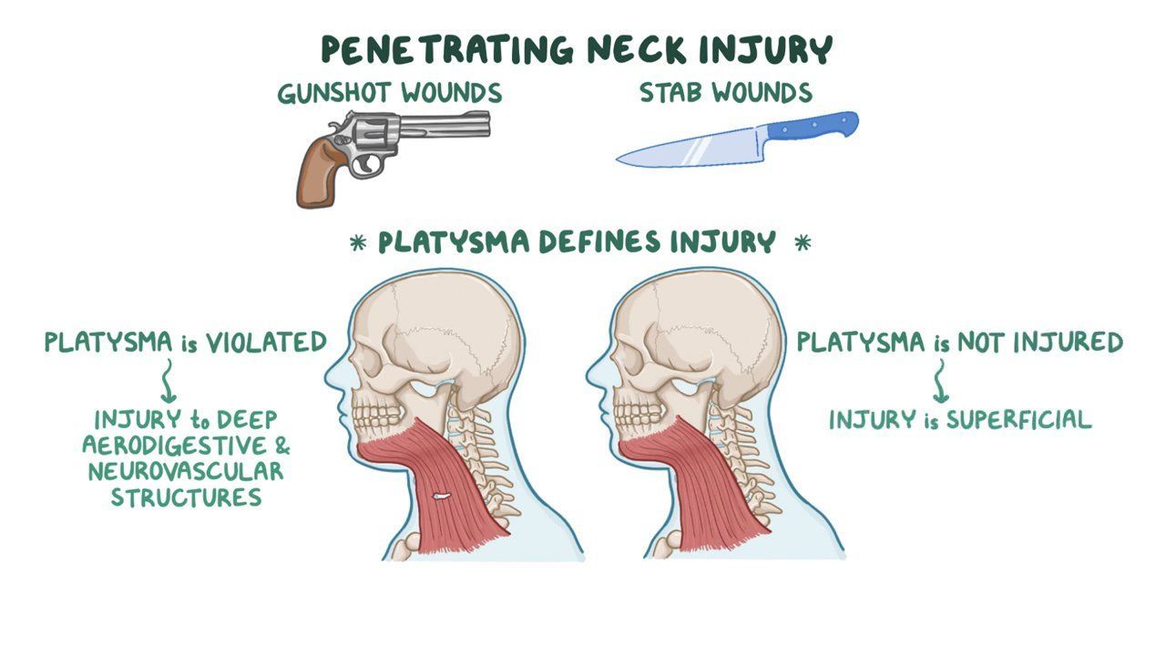 The survival rate of neck injury whether by stab wound or gunshot wound is around 11%. creamytowel.com